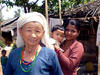 women in camp 296